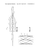 CATHETER SYSTEM AND METHODS OF USING SAME diagram and image