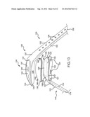 TWO-PIECE WRISTBAND WITH INTERCHANGEABLE LASSO BAND ELEMENT FOR USER     SELECTABLE SIZING diagram and image