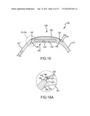 TWO-PIECE WRISTBAND WITH INTERCHANGEABLE LASSO BAND ELEMENT FOR USER     SELECTABLE SIZING diagram and image