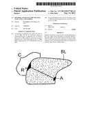 Methods and Devices for Treating Sleep Apnea and Snoring diagram and image