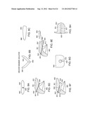 Methods and Devices for Treating Sleep Apnea and Snoring diagram and image