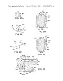 Methods and Devices for Treating Sleep Apnea and Snoring diagram and image