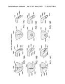 Methods and Devices for Treating Sleep Apnea and Snoring diagram and image