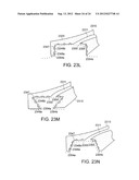 Methods and Devices for Treating Sleep Apnea and Snoring diagram and image