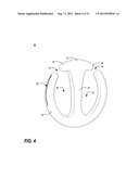 APPARATUS FOR CARRYING ONE OR MORE SUSPENDED ITEMS diagram and image