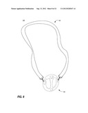 APPARATUS FOR CARRYING ONE OR MORE SUSPENDED ITEMS diagram and image