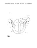 APPARATUS FOR CARRYING ONE OR MORE SUSPENDED ITEMS diagram and image