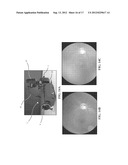 HAND-HELD PORTABLE FUNDUS CAMERA FOR SCREENING PHOTOGRAPHY diagram and image