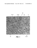 System and Method for Counting Follicular Units diagram and image