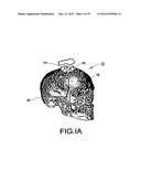 PRODUCING A THREE DIMENSIONAL MODEL OF AN IMPLANT diagram and image