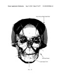 PRODUCING A THREE DIMENSIONAL MODEL OF AN IMPLANT diagram and image