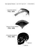 PRODUCING A THREE DIMENSIONAL MODEL OF AN IMPLANT diagram and image