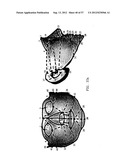 PRODUCING A THREE DIMENSIONAL MODEL OF AN IMPLANT diagram and image