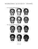 PRODUCING A THREE DIMENSIONAL MODEL OF AN IMPLANT diagram and image