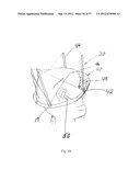 PRODUCING A THREE DIMENSIONAL MODEL OF AN IMPLANT diagram and image