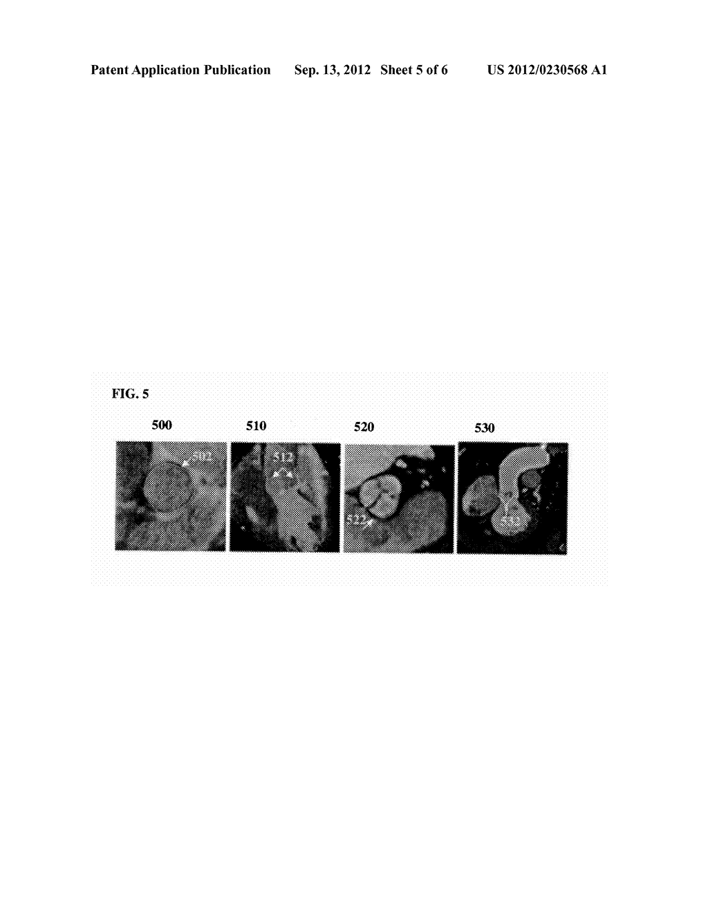 Method and System for Model-Based Fusion of Multi-Modal Volumetric Images - diagram, schematic, and image 06