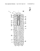 SLIDING ANCHOR diagram and image