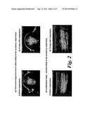 PHARMACEUTICAL KITS COMPRISING MESENCHYMAL STEM CELLS diagram and image