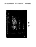 PHARMACEUTICAL KITS COMPRISING MESENCHYMAL STEM CELLS diagram and image