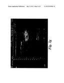 PHARMACEUTICAL KITS COMPRISING MESENCHYMAL STEM CELLS diagram and image