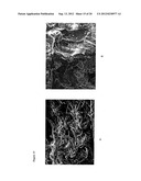 FLOWABLE COLLAGEN-BASED HEMOSTAT AND METHODS OF USE diagram and image