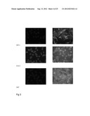 MONOCLONAL ANTIBODIES AND SINGLE CHAIN ANTIBODY FRAGMENTS AGAINST     CELL-SURFACE PROSTATE SPECIFIC MEMBRANE ANTIGEN AS DIAGNOSTIC AND     THERAPEUTIC TOOLS FOR PROSTATE CANCER diagram and image