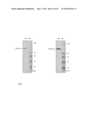 MONOCLONAL ANTIBODIES AND SINGLE CHAIN ANTIBODY FRAGMENTS AGAINST     CELL-SURFACE PROSTATE SPECIFIC MEMBRANE ANTIGEN AS DIAGNOSTIC AND     THERAPEUTIC TOOLS FOR PROSTATE CANCER diagram and image