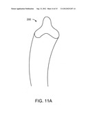 TEXTILE FABRIC WITH HIGH INSULATION TO WEIGHT RATIO diagram and image