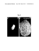 Production of beta-cells diagram and image