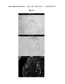 Production of beta-cells diagram and image