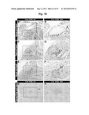 Production of beta-cells diagram and image