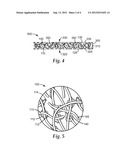 Porous Supported Articles and Methods of Making diagram and image