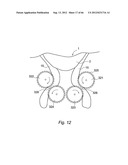 METHOD AND DEVICE FOR PROCESSING A CARCASS PART OF SLAUGHTERED POULTRY diagram and image