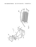 METHOD AND DEVICE FOR PROCESSING A CARCASS PART OF SLAUGHTERED POULTRY diagram and image