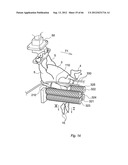 METHOD AND DEVICE FOR PROCESSING A CARCASS PART OF SLAUGHTERED POULTRY diagram and image