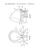 METHOD AND DEVICE FOR PROCESSING A CARCASS PART OF SLAUGHTERED POULTRY diagram and image