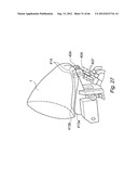 METHOD AND DEVICE FOR PROCESSING A CARCASS PART OF SLAUGHTERED POULTRY diagram and image