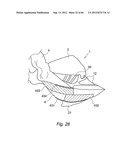 METHOD AND DEVICE FOR PROCESSING A CARCASS PART OF SLAUGHTERED POULTRY diagram and image