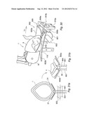 METHOD AND DEVICE FOR PROCESSING A CARCASS PART OF SLAUGHTERED POULTRY diagram and image