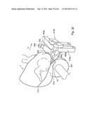 METHOD AND DEVICE FOR PROCESSING A CARCASS PART OF SLAUGHTERED POULTRY diagram and image