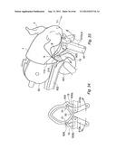 METHOD AND DEVICE FOR PROCESSING A CARCASS PART OF SLAUGHTERED POULTRY diagram and image