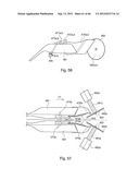 METHOD AND DEVICE FOR PROCESSING A CARCASS PART OF SLAUGHTERED POULTRY diagram and image