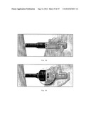 REDUCED VOLUME FORMULATION OF GLATIRAMER ACETATE AND METHODS OF     ADMINISTRATION diagram and image