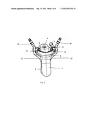 VAGINAL DILATOR HAVING SIDE BLADES OR HAVING UPPER AND LOWER BLADES     COMPRISING ACCESSORIAL BLADES diagram and image