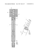 MEDICAL IMPLANATBLE LEAD WITH FIXATION DETECTION diagram and image