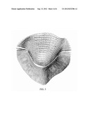 VALVE TREATMENT SIMULATION FROM MEDICAL DIAGNOSTIC IMAGING DATA diagram and image