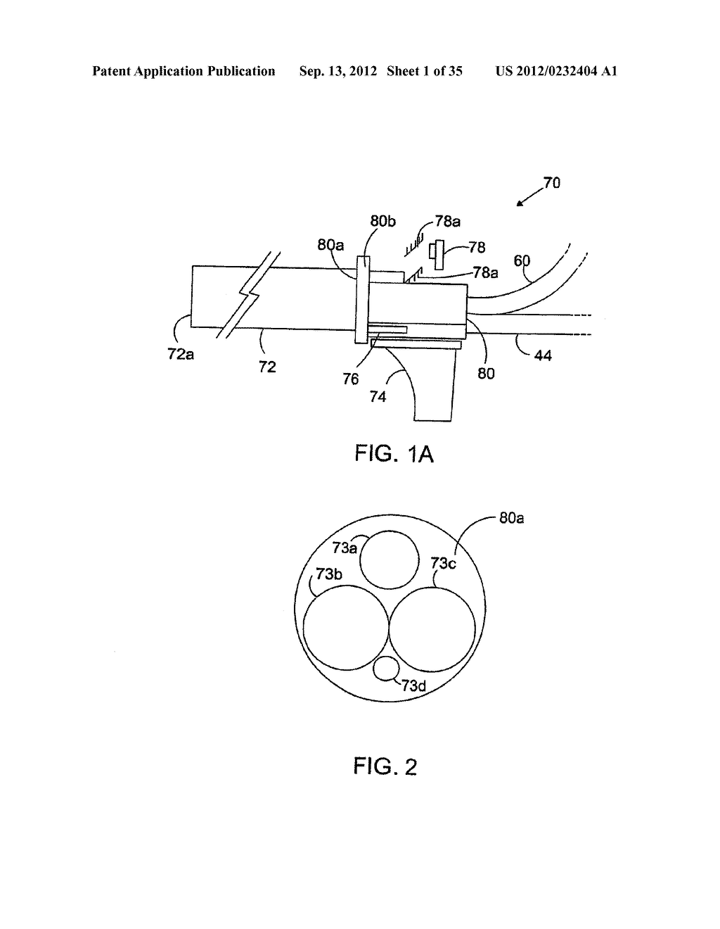 Method And Apparatus For Rapid Detection And Diagnosis Of Tissue     Abnormalities - diagram, schematic, and image 02