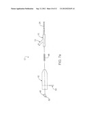 ULTRASOUND CATHETER AND METHODS FOR MAKING AND USING SAME diagram and image