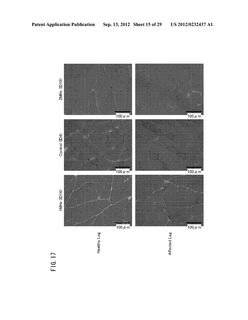 DEVICE FOR MODULATING PGC-1 EXPRESSION, AND TREATING DEVICE AND TREATING     METHOD FOR ISCHEMIC DISEASE - diagram, schematic, and image 16