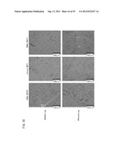 DEVICE FOR MODULATING PGC-1 EXPRESSION, AND TREATING DEVICE AND TREATING     METHOD FOR ISCHEMIC DISEASE diagram and image